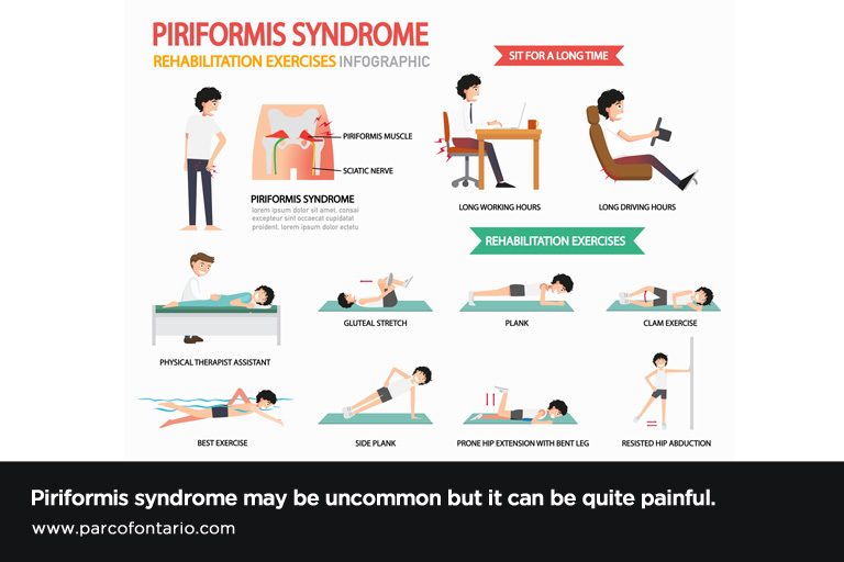 Finding Comfort: How to Sit with Piriformis Syndrome and Relieve Pain -  Kinetic Labs