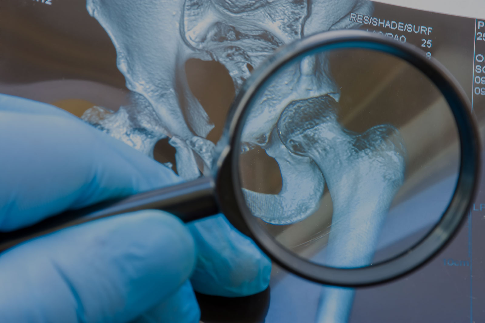 rehumatology