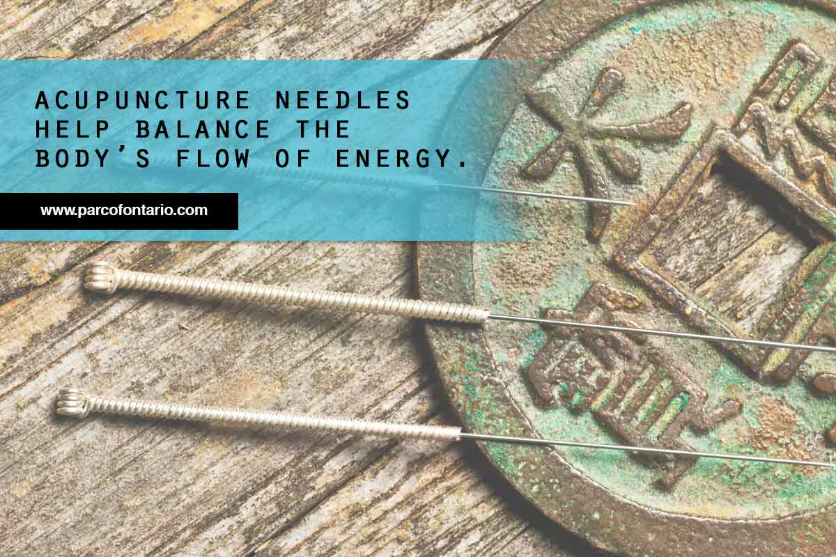 Acupuncture-needles-help-balance-the-bodys-flow-of-energy