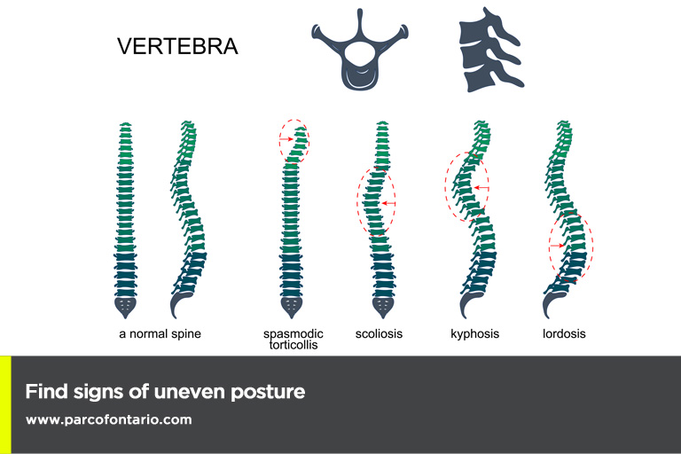 Find signs of uneven posture