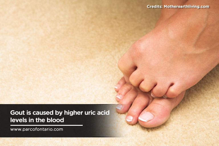 Gout is caused by higher uric acid levels 