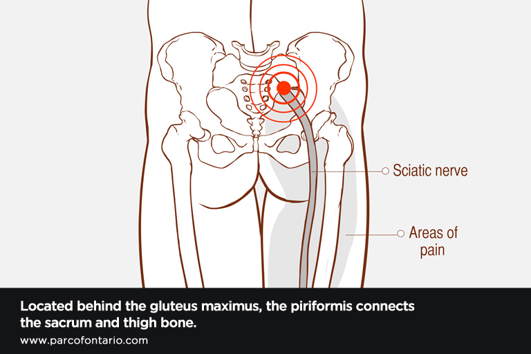 Located-behind-the-gluteus-maximus,-the-piriformis-connects-the-sacrum-and-thigh-bone
