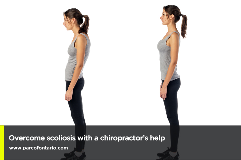  Overcome scoliosis with a chiropractor’s help