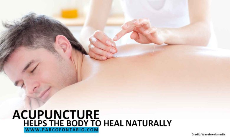 Acupuncture helps the body to heal naturally