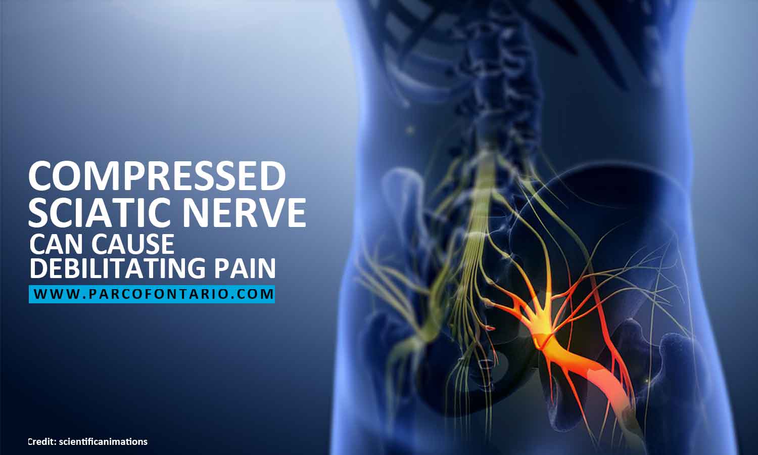 sciatic nerve can cause debilitating pain