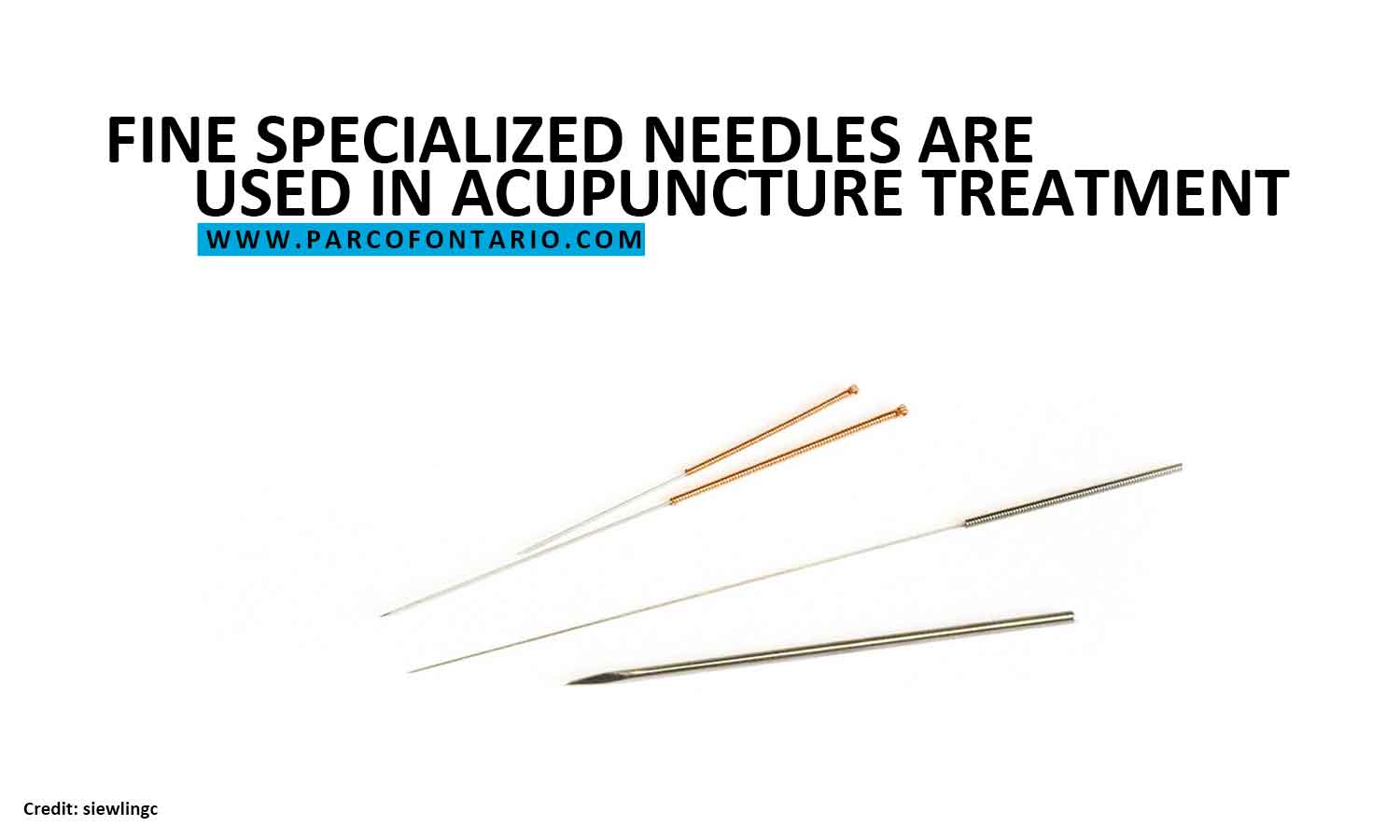 needles are used in acupuncture treatment