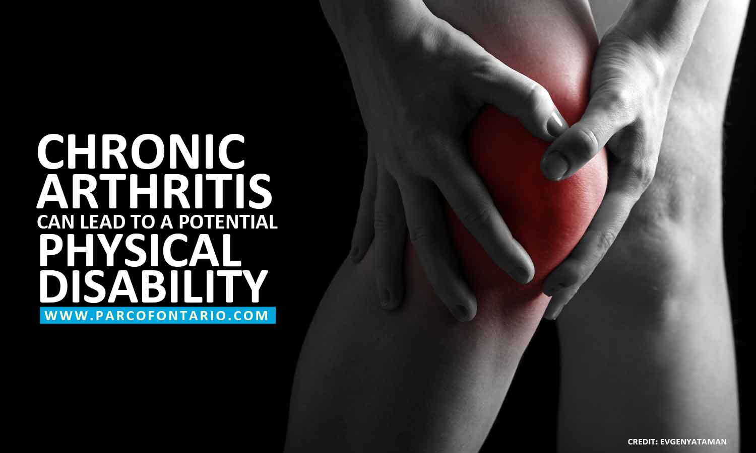 Chronic arthritis can lead to a potential physical disability