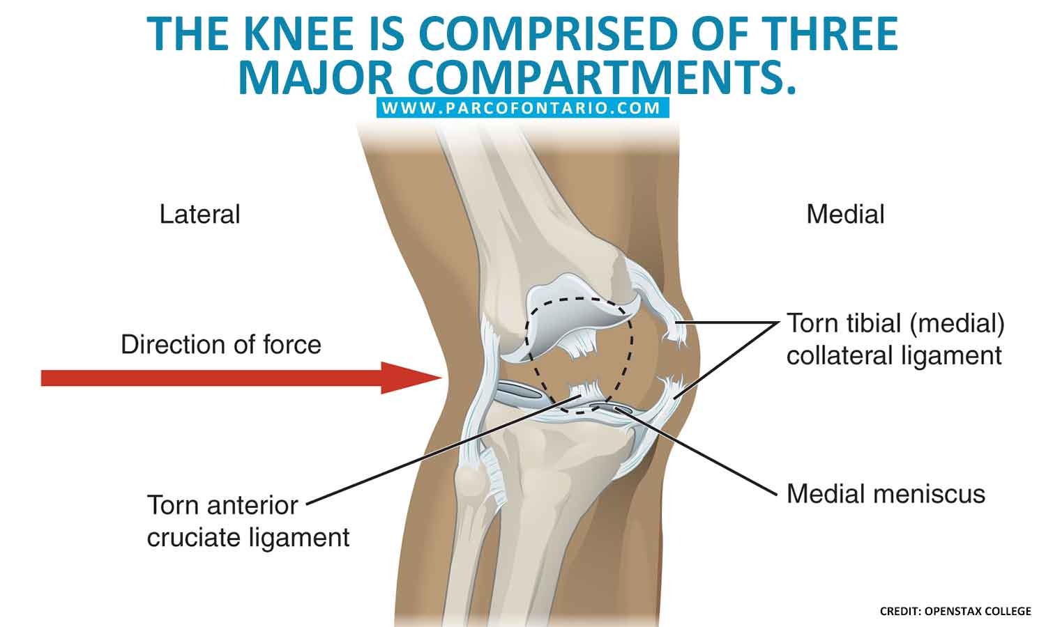 knee is comprised of three major compartments