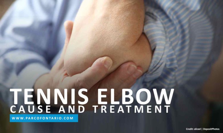 Tennis-Elbow-Cause-Treatment