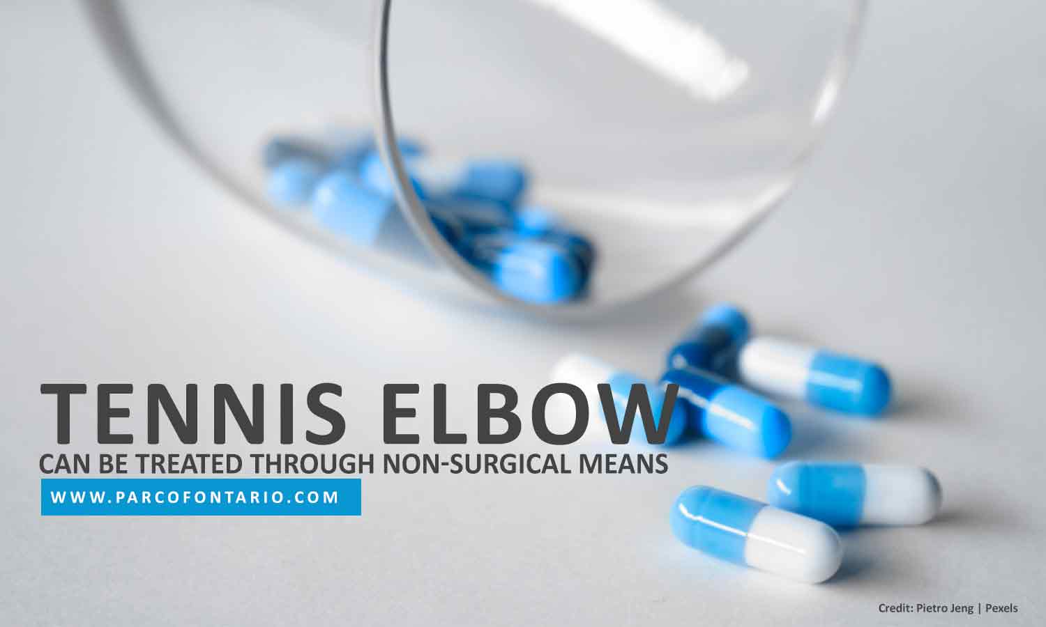 Tennis elbow can be treated