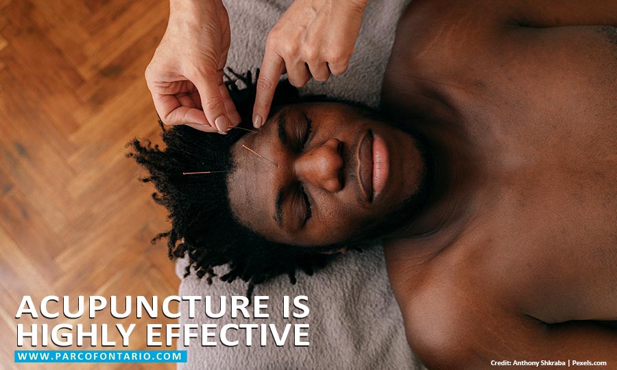 Acupuncture is highly effective