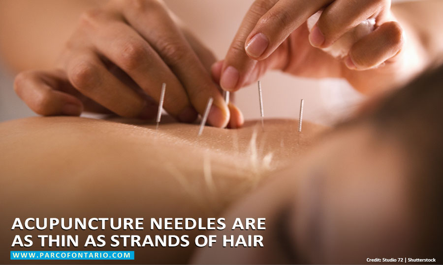 Acupuncture needles are as thin as strands of hair