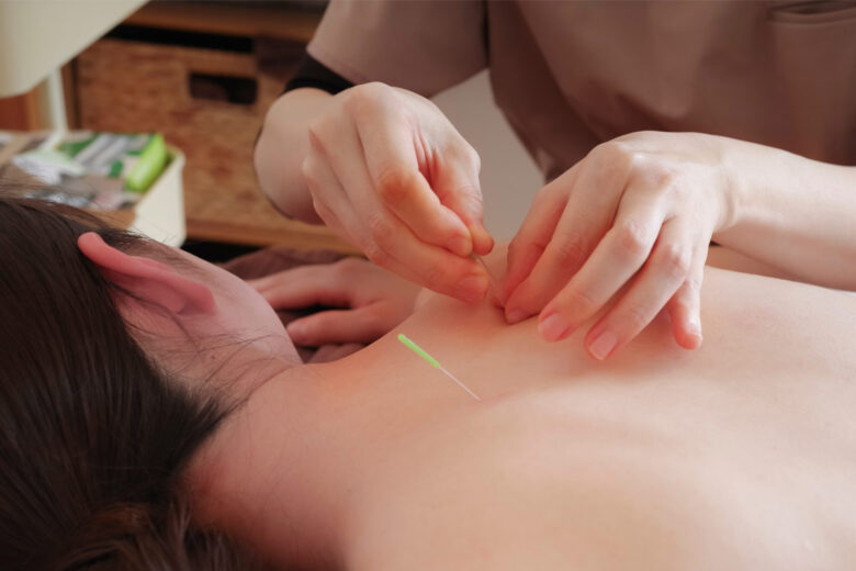 Acupuncture-Points-Explained