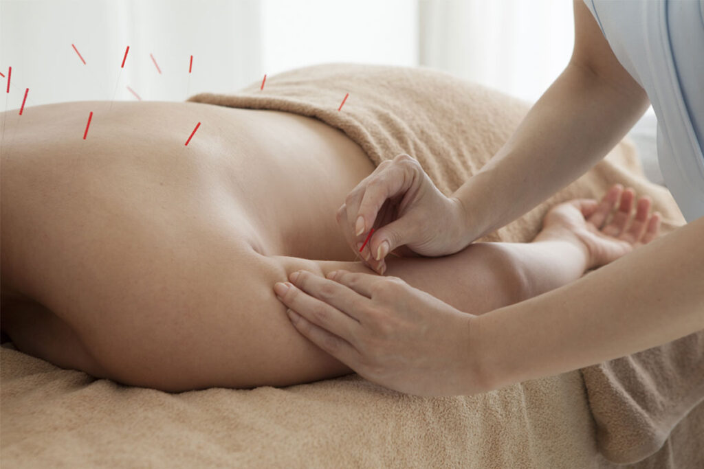 How-to-Get-the-Most-from-Acupuncture