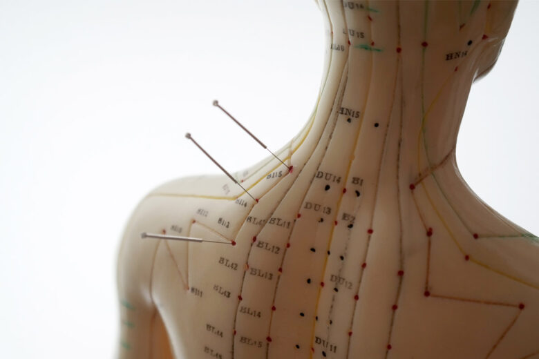 Why-Do-Reactions-to-Acupuncture-Differ-from-Person-to-Person