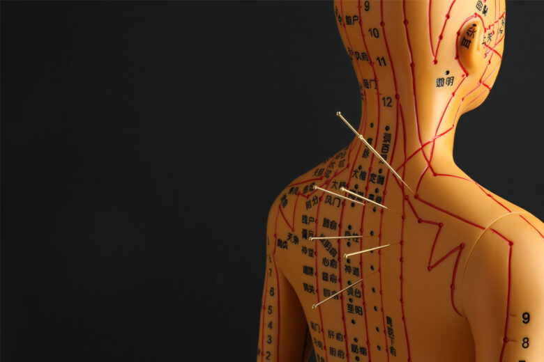 Why-Is-Acupuncture-Gaining-Attention-Beyond-Pain-Management