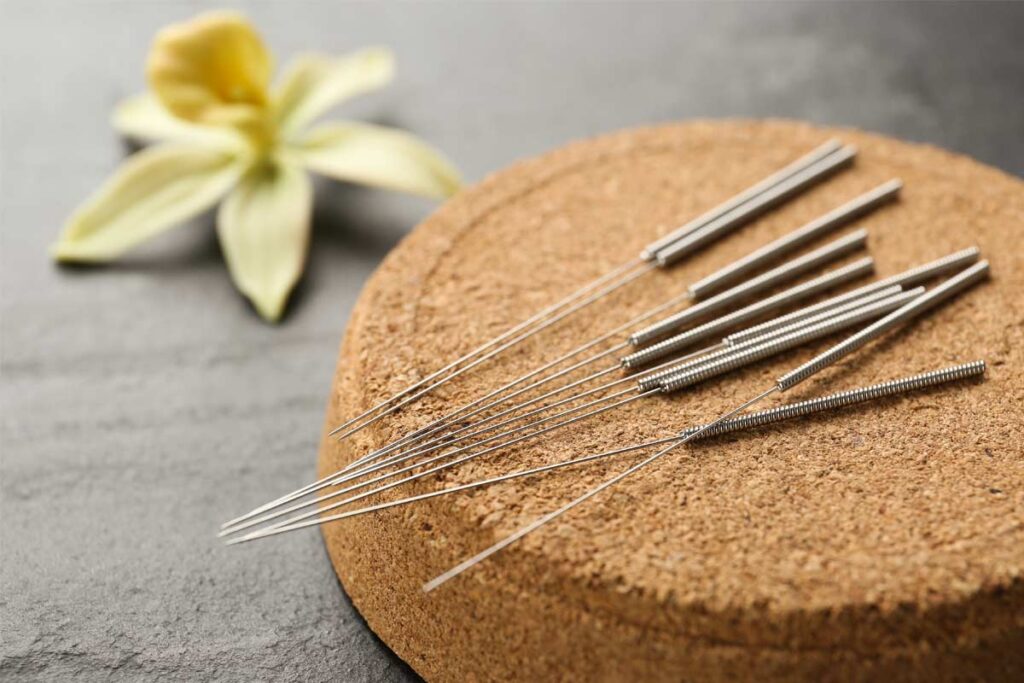 Acupuncture-and-Younger-Adults