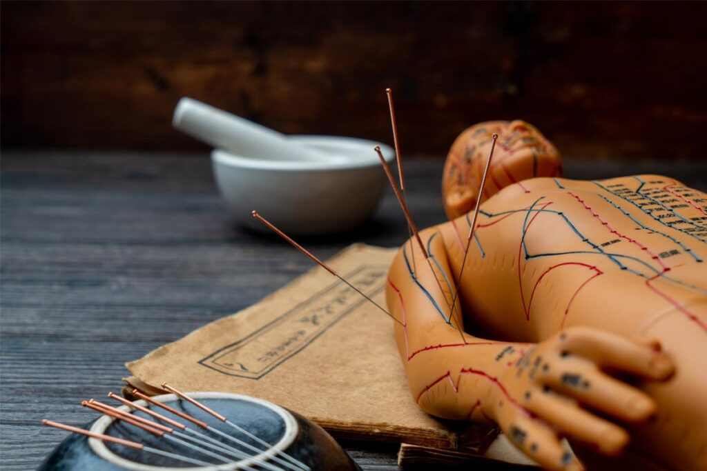 Common-Misconceptions-About-Acupuncture