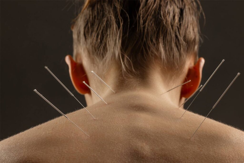 Why-Patience-and-Consistency-Matter-in-Acupuncture-Treatment