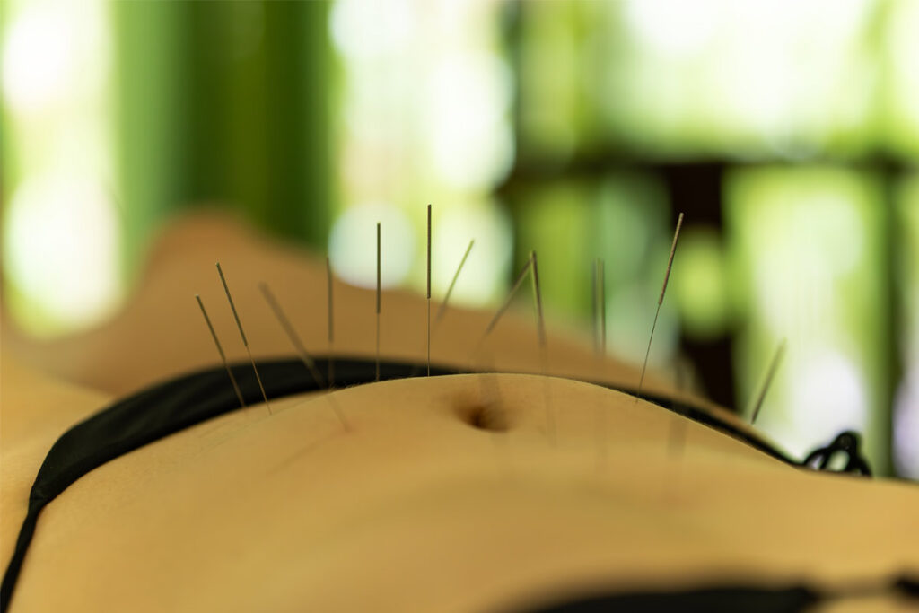How-Acupuncture-Intersects-with-Biology