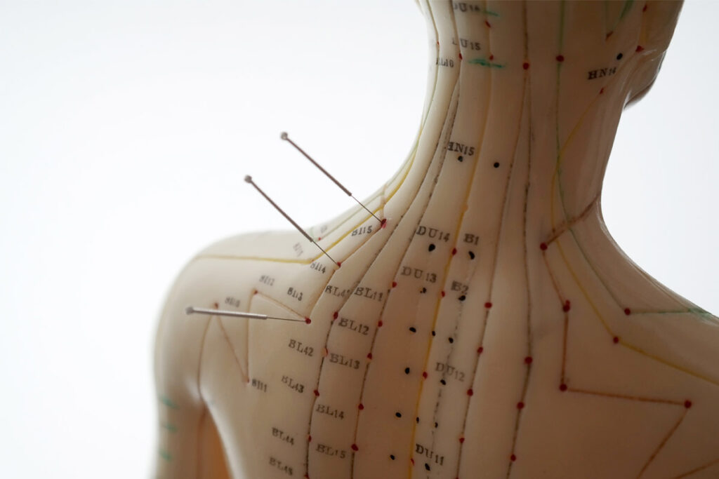 Rewiring-the-Pain-Brain