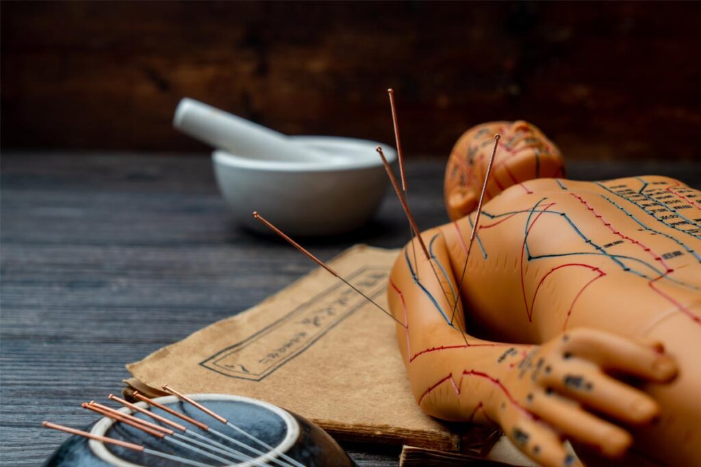 How-Many-Acupuncture-Sessions-Are-Needed-for-Chronic-Pain-Relief